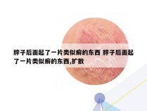 脖子后面起了一片类似癣的东西 脖子后面起了一片类似癣的东西,扩散