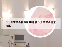 2个月宝宝会得银屑病吗 两个月宝宝会得紫癜吗