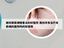 廊坊银屑病哪里治的好医院 廊坊市有治疗皮肤病的医院吗的短视频