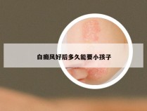 白癜风好后多久能要小孩子