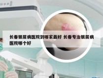 长春银屑病医院到哪家最好 长春专治银屑病医院哪个好