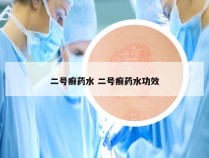 二号癣药水 二号癣药水功效
