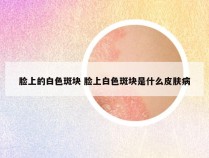 脸上的白色斑块 脸上白色斑块是什么皮肤病