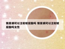银屑病可以注射玻尿酸吗 银屑病可以注射玻尿酸吗女性