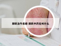 胆矾治牛皮癣 胆矾中药名叫什么