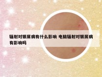 辐射对银屑病有什么影响 电脑辐射对银屑病有影响吗