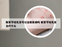 联苯苄唑乳膏可以治银屑病吗 联苯苄唑乳膏治疗什么