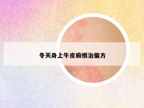 冬天身上牛皮癣根治偏方
