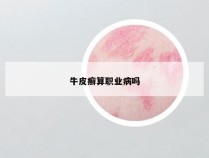 牛皮癣算职业病吗
