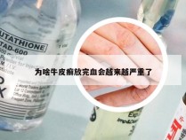 为啥牛皮癣放完血会越来越严重了
