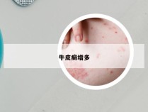 牛皮癣增多