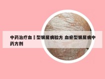 中药治疗血癒型银屑病验方 血瘀型银屑病中药方剂