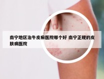 南宁地区治牛皮癣医院哪个好 南宁正规的皮肤病医院
