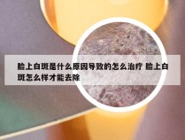 脸上白斑是什么原因导致的怎么治疗 脸上白斑怎么样才能去除