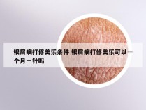 银屑病打修美乐条件 银屑病打修美乐可以一个月一针吗