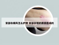 背部白癜风怎么护理 背部白斑的原因造成的