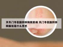 天冬门冬氨酸转移酶银屑病 天门冬氨酸转移酶偏低是什么意思