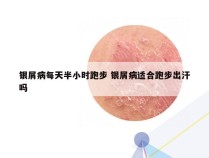 银屑病每天半小时跑步 银屑病适合跑步出汗吗