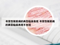 寻常性银屑病的典型临床表现 寻常性银屑病的典型临床表现不包括