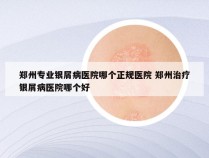 郑州专业银屑病医院哪个正规医院 郑州治疗银屑病医院哪个好