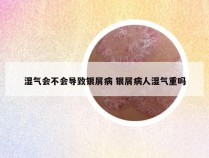湿气会不会导致银屑病 银屑病人湿气重吗