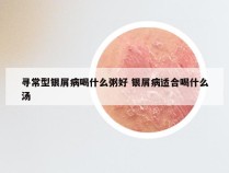 寻常型银屑病喝什么粥好 银屑病适合喝什么汤