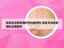 南昌有治银屑病的专科医院吗 南昌专治皮肤病的正规医院