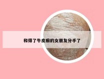 和得了牛皮癣的女朋友分手了
