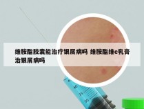 维胺酯胶囊能治疗银屑病吗 维胺酯维e乳膏治银屑病吗