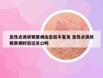 急性点滴状银屑病治愈后不复发 急性点滴状银屑病好后还忌口吗