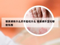银屑病有什么药不能吃什么 银屑病不宜吃哪些东西