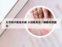 九岁孩子鬓角长癣 小孩鬓角长一颗颗白斑图片