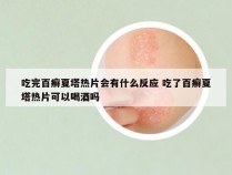 吃完百癣夏塔热片会有什么反应 吃了百癣夏塔热片可以喝酒吗