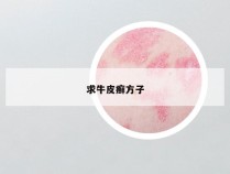 求牛皮癣方子