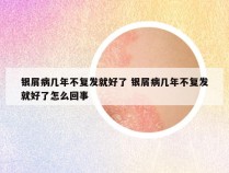银屑病几年不复发就好了 银屑病几年不复发就好了怎么回事