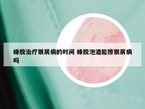 蜂胶治疗银屑病的时间 蜂胶泡酒能擦银屑病吗