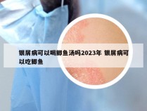 银屑病可以喝鲫鱼汤吗2023年 银屑病可以吃鲫鱼
