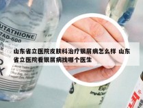 山东省立医院皮肤科治疗银屑病怎么样 山东省立医院看银屑病找哪个医生