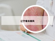 辽宁看白癜风