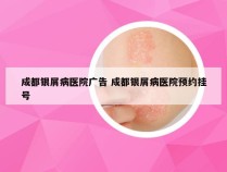 成都银屑病医院广告 成都银屑病医院预约挂号