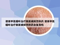 使用甲氨蝶呤治疗银屑病突然停药 使用甲氨蝶呤治疗银屑病突然停药会复发吗