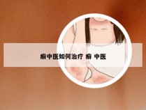 癣中医如何治疗 癣 中医