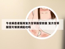 牛皮癣患者服用复方甘草酸苷胶囊 复方甘草酸苷片银屑病能吃吗