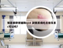 银屑病使用辅酶Q10 副银屑病吃点维生素c可以吗?