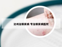 沧州治银屑病 专治银屑病医院