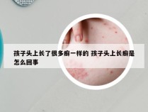 孩子头上长了很多癣一样的 孩子头上长癣是怎么回事