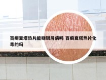 百癣夏塔热片能赚银屑病吗 百癣夏塔热片化毒的吗