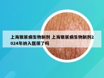 上海银屑病生物制剂 上海银屑病生物制剂2024年纳入医保了吗