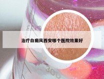 治疗白癜风西安哪个医院效果好