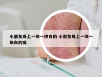 小朋友身上一块一块白的 小朋友身上一块一块白的痒